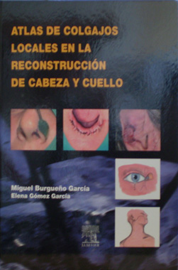 Atlas de Colgajos Locales en la Reconstruccion de Cabeza y Cuello
