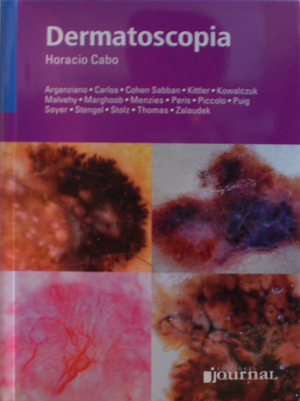 Libro: Dermatoscopia Autor: Horacio Cabo