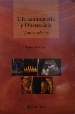 Ultrasonografia y Obstetricia Temas Selectos