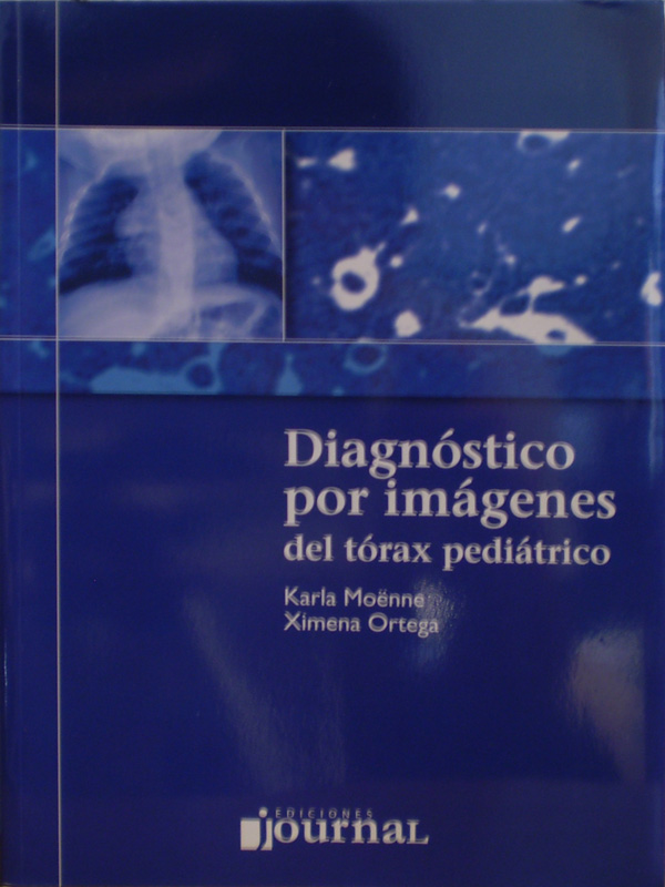 Libro: Diagnostico por Imagenes del Torax Pediatrico Autor: Karla Moenne / Ximena Ortega