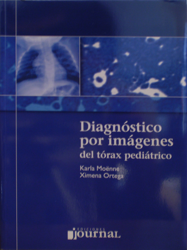 Libro: Diagnostico por Imagenes del Torax Pediatrico Autor: Karla Moenne / Ximena Ortega