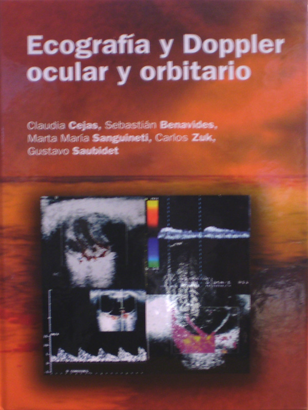 Libro: Ecografia y Doppler Ocular y Orbitario Autor: Claudia Cejas