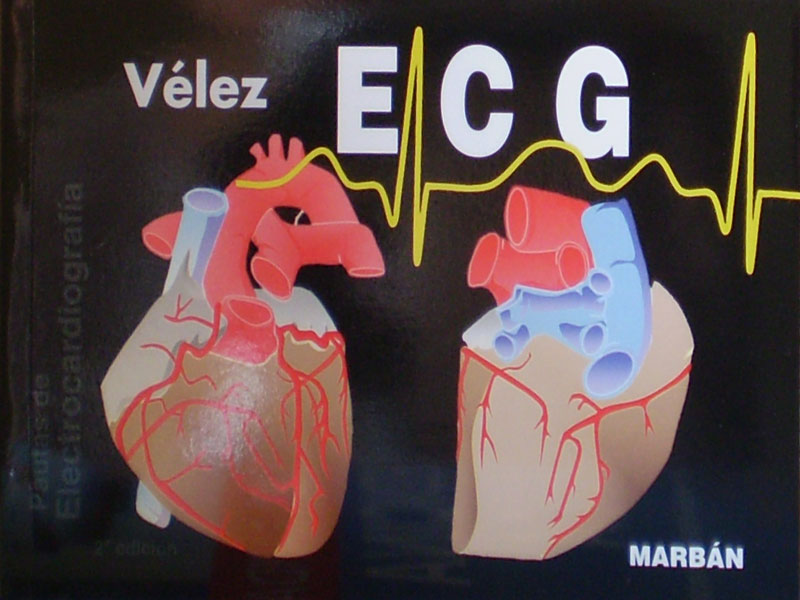 Libro: Manual ECG Pautas de Electrocardiografia 2a. Edicion Autor: Velez