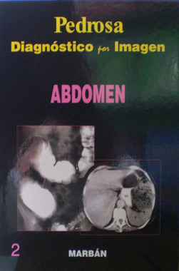 Diagnostico por Imagen: Abdomen T.D.