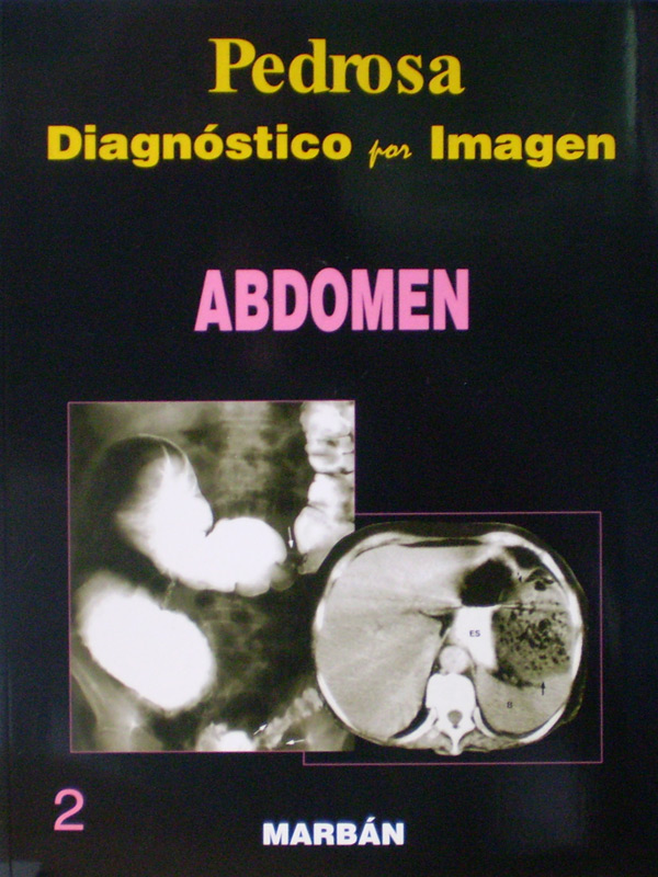Libro: Flexilibro Diagnostico por Imagen: Abdomen Autor: Pedrosa 2