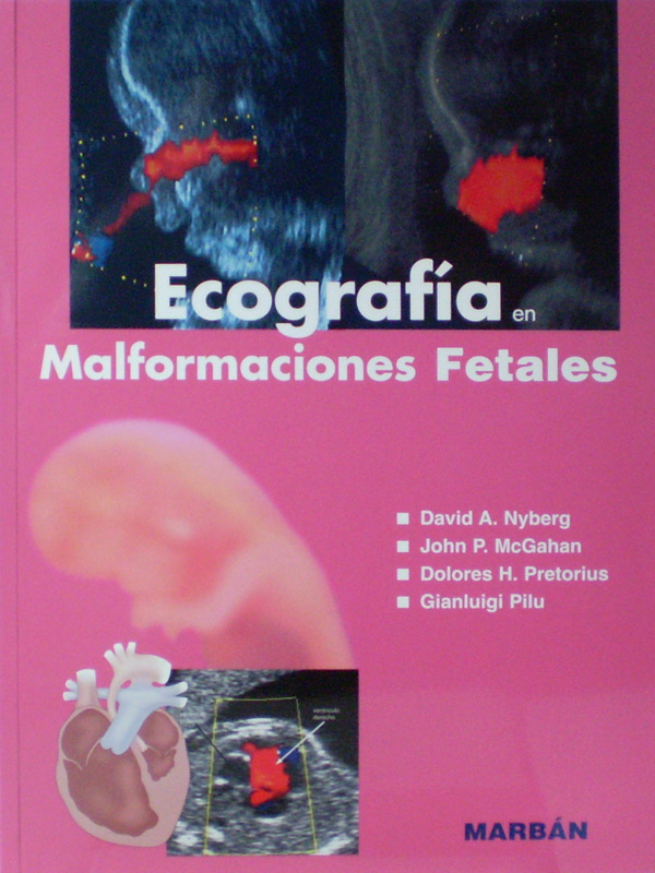 Libro: Flexilibro Ecografia en Malformaciones Fetales Autor: David. A. Nyberg