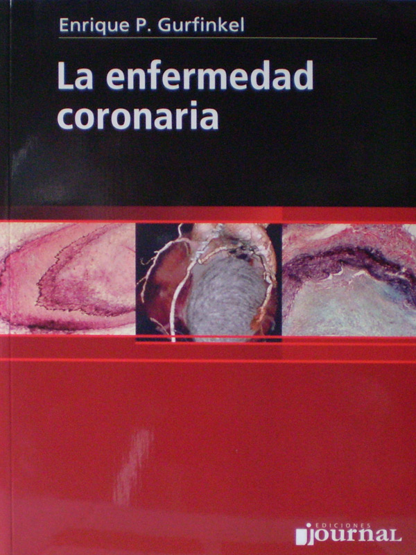 Libro: La Enfermedad Coronaria Autor: Enrique P. Gurfinkel