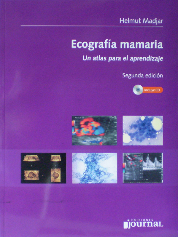 Libro: Ecografia Mamaria Un Atlas para el Aprendizaje 2a. Edicion con CD Autor: Helmut Madjar