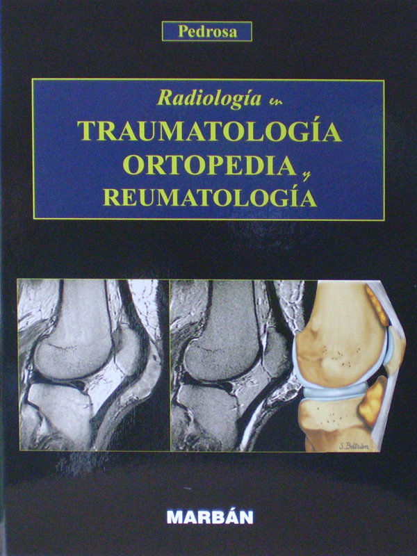 Libro: Radiologia en Traumatologia, Ortopedia y Reumatologia Autor: Pedrosa