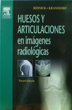 Huesos y Articulaciones en Imagenes Radiologicas, 3a. Edicion. 
