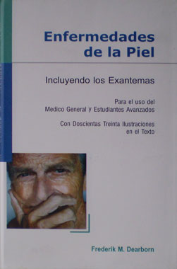 Enfermedades de la Piel, Incluyendo los Exantemas, para el uso del Medico General y Estudiantes Avanzados