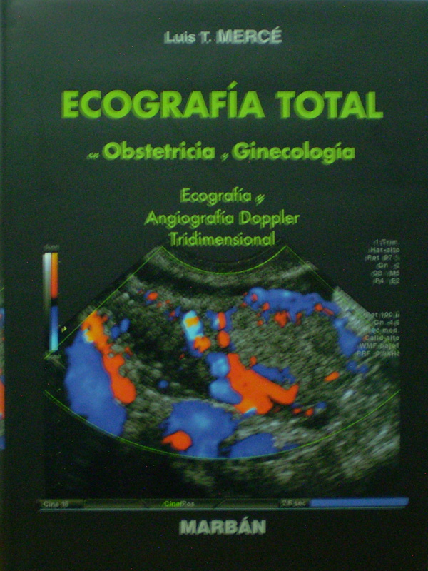 Libro: Ecografia Total en Obstetricia y Ginecologia T.D. Ecografia y Angiografia Doppler Tridimencional Autor: Luis T. Merce