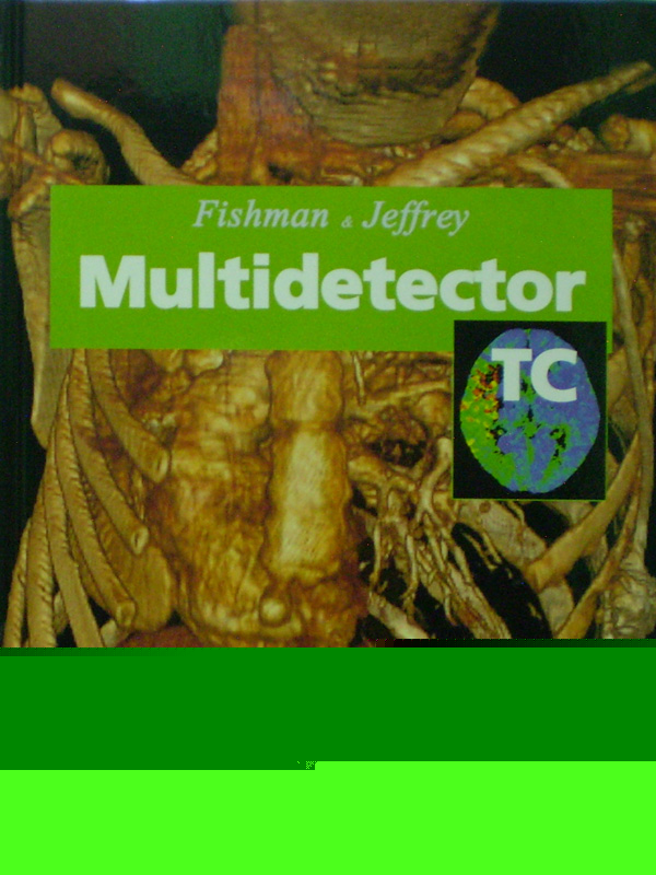 Libro: Multidetector TC   Autor: Fishman
