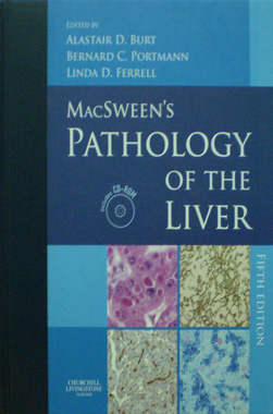 MacSween's Pathology of the Liver 5th. Ed. + CD 