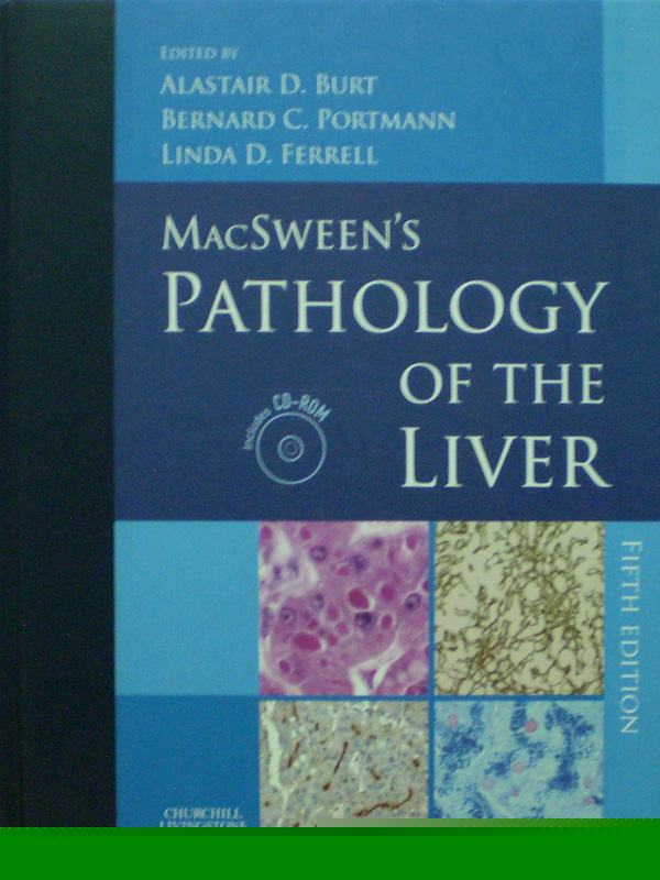 Libro: MacSween's Pathology of the Liver 5th. Ed. + CD  Autor: Alastair D. Burt