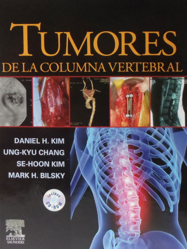 Libro: Tumores de la Columna Vertebral Autor: Daniel H. Kim, Ung-Kyu Chang, Se-Hoon Kim, Mark H. Bilsky