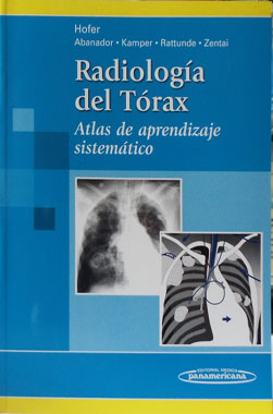 Radiología del Torax, Atlas de Aprendizaje Sistematico