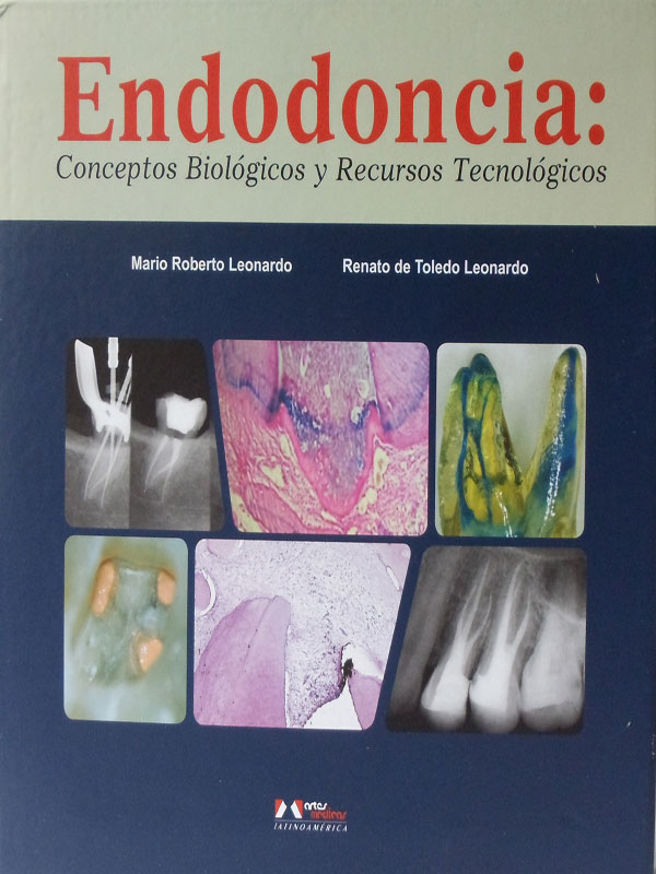 Libro: Endodoncia, Conceptos Biologicos y Recursos Tecnologicos Autor: Mario Roberto Leonardo, Renato de Toledo Leonardo