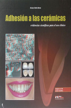 Adhesion a las Ceramicas, Evidencias Cientificas para el uso Clinico