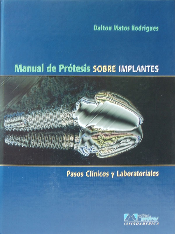 Libro: Manual de Protesis Sobre Implantes Autor: Dalton Matos Rodrigues