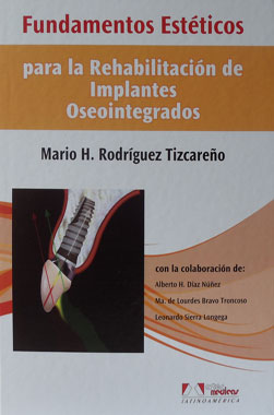 Fundamentos Esteticos para la Rehabilitacion de Implantes Oseointegrados