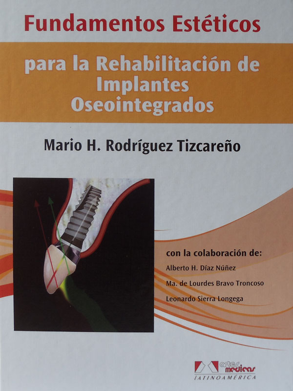Libro: Fundamentos Esteticos para la Rehabilitacion de Implantes Oseointegrados Autor: Mario H. Rodriguez Tizcareño