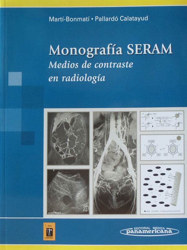Libro: Monografia SERAM, Medios de Contraste en Radiologia Autor: Marti Bonmati, Pallardo Calatayud