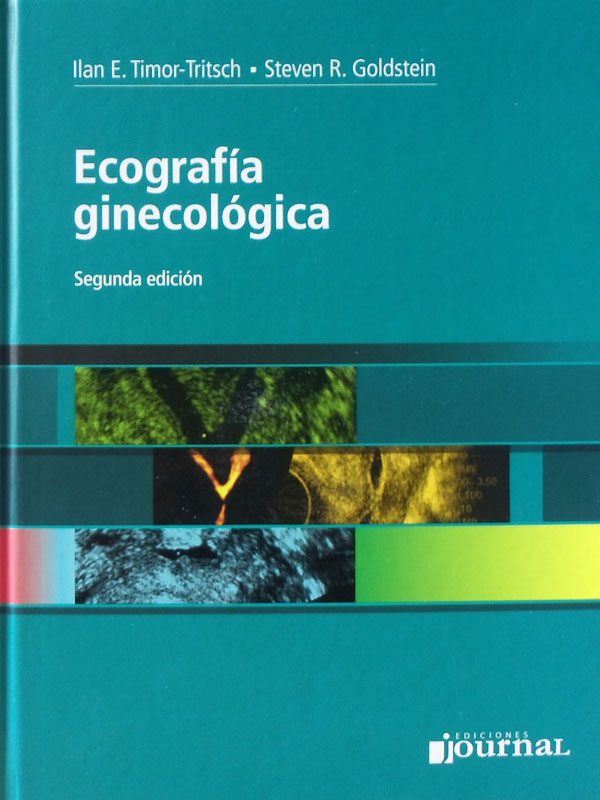 Libro: Ecografia Ginecologica, 2a. Edicion Autor: Ilan E. Timor-Tritsch, Steven R. Goldstein