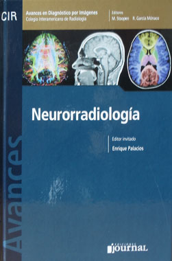 Avances en Diagnostico por Imagenes Neurorradiologia
