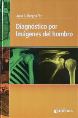 Diagnostico por Imagenes del Hombro