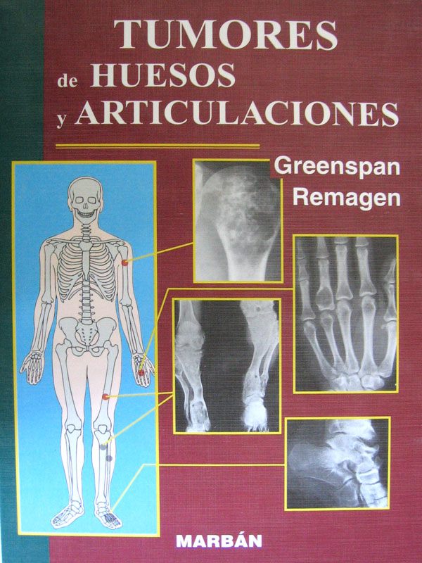 Libro: Tumores de Huesos y Articulaciones Autor: Greenspan