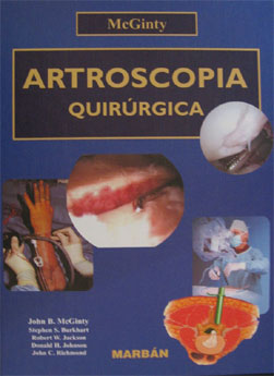 Artroscopia Quirurgica