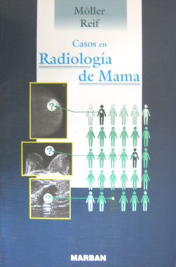 Casos de Radiologia de Mama