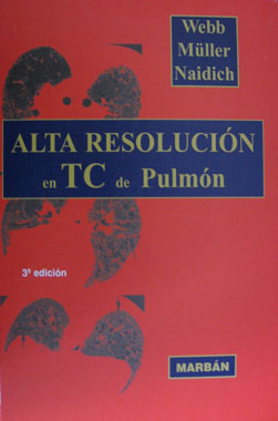 Alta Resolucion en TC de Pulmon