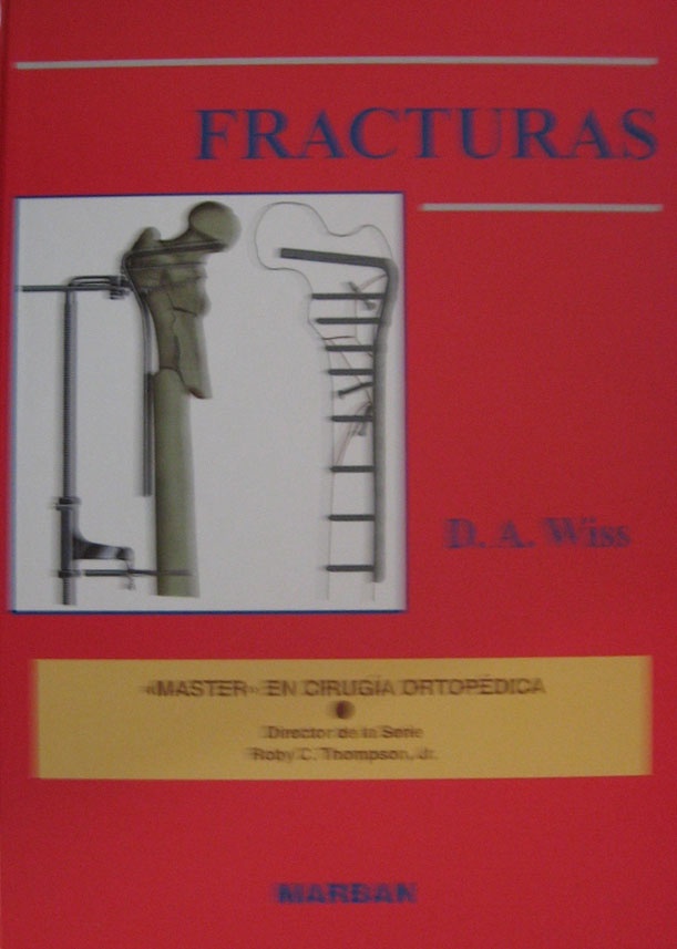Libro: Fracturas T.D. Gran Formato Autor: Wiss