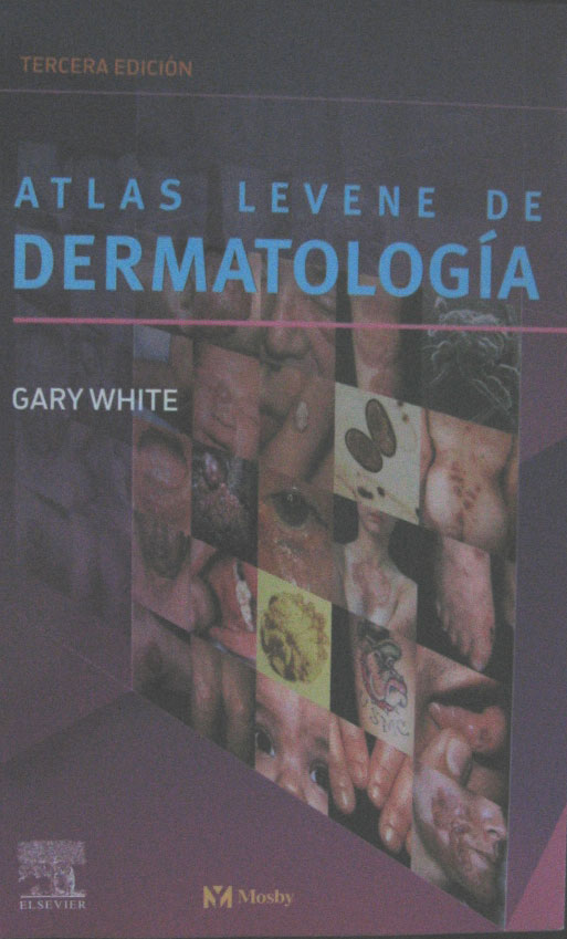 Libro: Atlas Levene de Dermatologia. 3a. Edicion Autor: G. White
