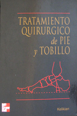 Tratamiento Quirurgico del Pie y Tobillo