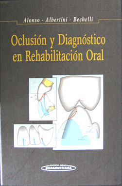 Oclusion Diagnostico y Rehabilitacion