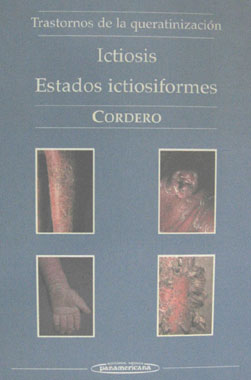 Ictiosis