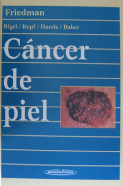 Cancer de Piel