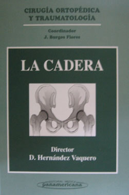 La Cadera