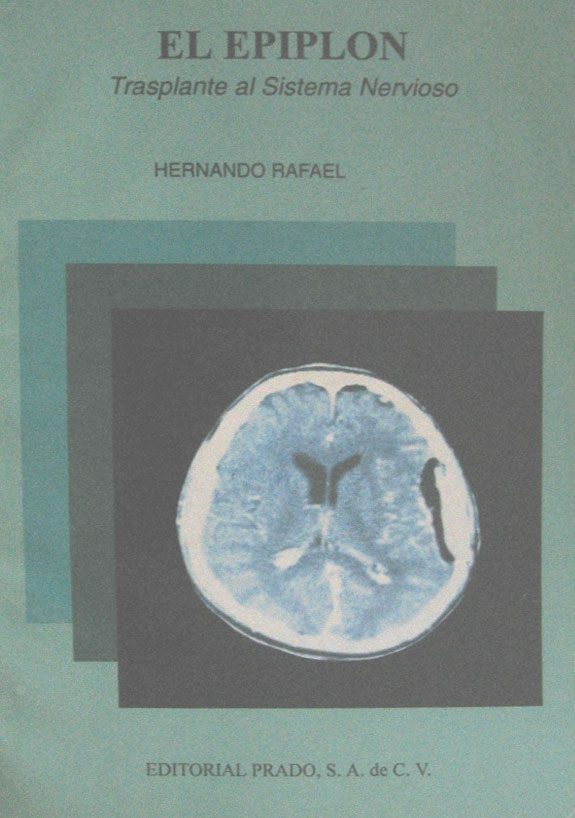 Libro: El Epiplom Autor: Rafael