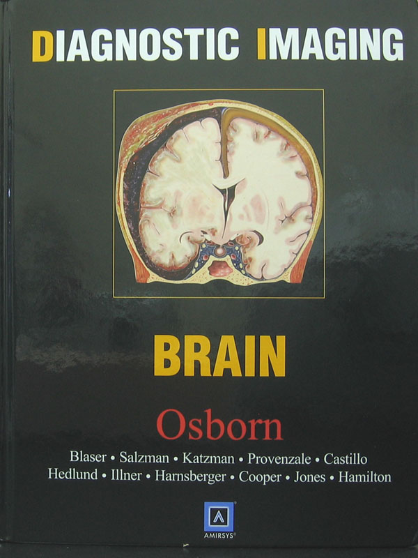 Libro: Diagnostic Imaging - Brain Autor: Osborn, Blaser, Salzman, Katzman, Provenzale, Castillo, Hedlund, Illner, Hansberger, Cooper, Jones, Hamilton
