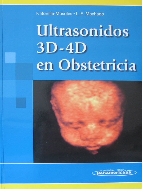 Libro: Ultrasonidos 3D-4D en Obstetricia Autor: F. Bonilla-Musoles, L. E. Machado