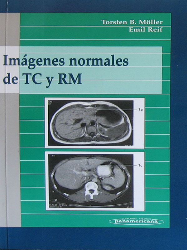 Libro: Imagenes Normales de TC y RM Autor: Torsten B. Moller, Emil Reif