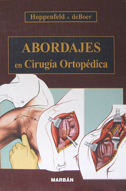 Abordajes en Cirugia Ortopedica