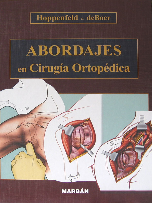 Libro: Abordajes en Cirugia Ortopedica Autor: Hoppenfeld, deBoer
