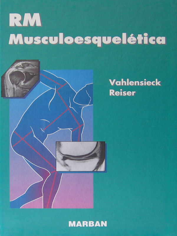 Libro: RM Musculoesqueletica Autor: Vahlensieck, Reiser