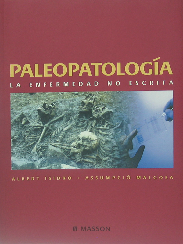 Libro: Paleopatologia, La Enfermedad no Escrita Autor: Albert Isidro, Assumpcio Malgosa