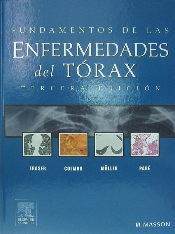 Libro: Fundamentos de las Enfermedades del Torax, 3a. Edicion Autor: R. S. Fraser, Coldman, Muller, Pare